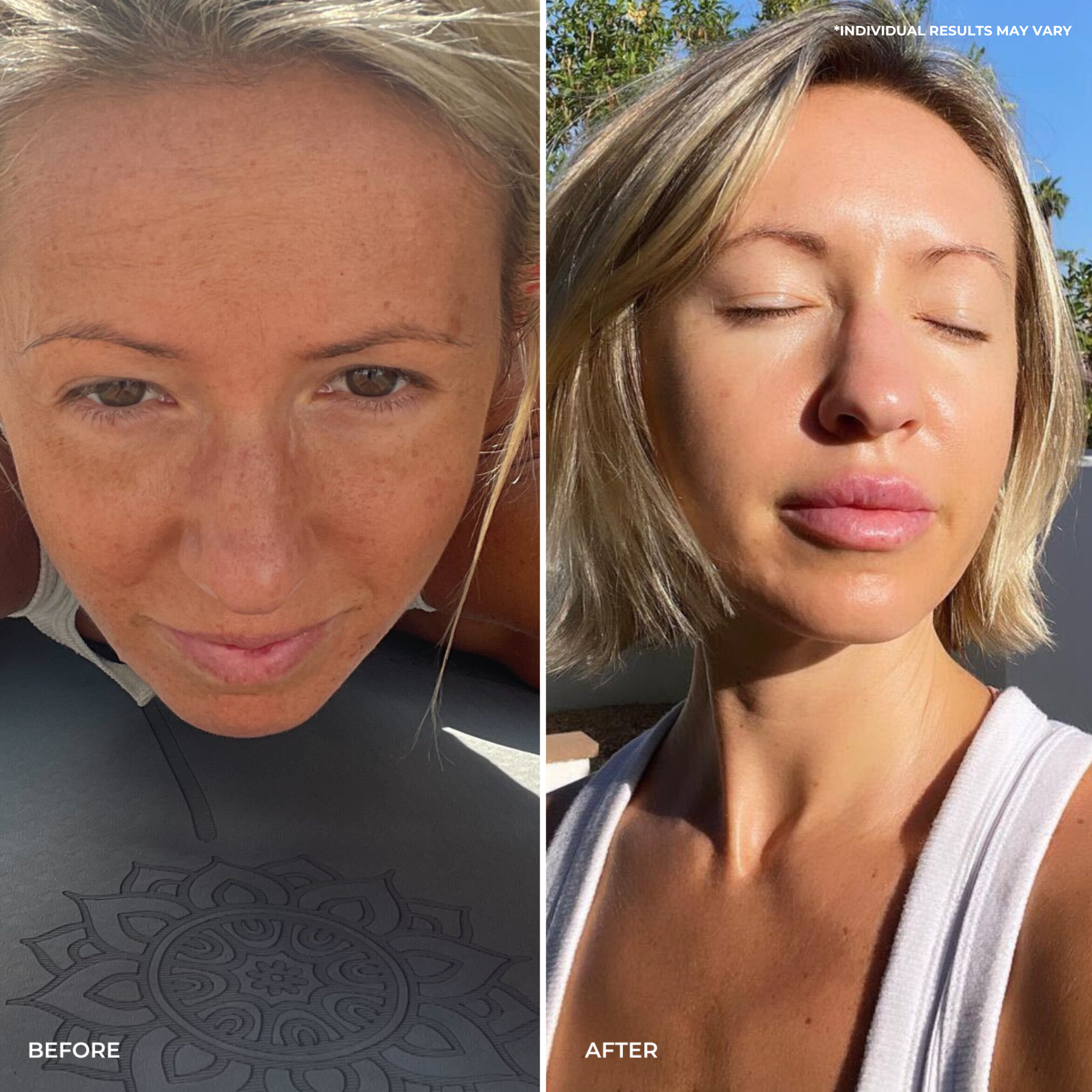 Side-by-side comparison of a woman’s face before and after using THE GOLDEN SECRETS Hydrate & Heal Duo. The left shows uneven skin tone—typical for sensitive skin; the right reveals her with eyes closed under sunlight, displaying smoother, brighter skin and a visibly restored skin barrier.
