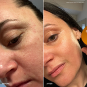 Side-by-side close-up of a woman’s face featuring a before image with uneven, aging skin and an after image showcasing smoother, clearer skin. In the after image, a hand holds THE GOLDEN SECRETS Instant Glow Facial Mask—an antioxidant-rich treatment that visibly enhances the complexion.