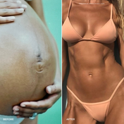 Side-by-side comparison: the left shows a close-up of a pregnant belly with a scar (“before”), while the right features a fit woman in a peach bikini with toned abs and visibly firmer skin (“after”)—demonstrating the potential benefits of Womb Wisdom Skin-Toning Oil by THE GOLDEN SECRETS for smoother, more youthful-looking results.