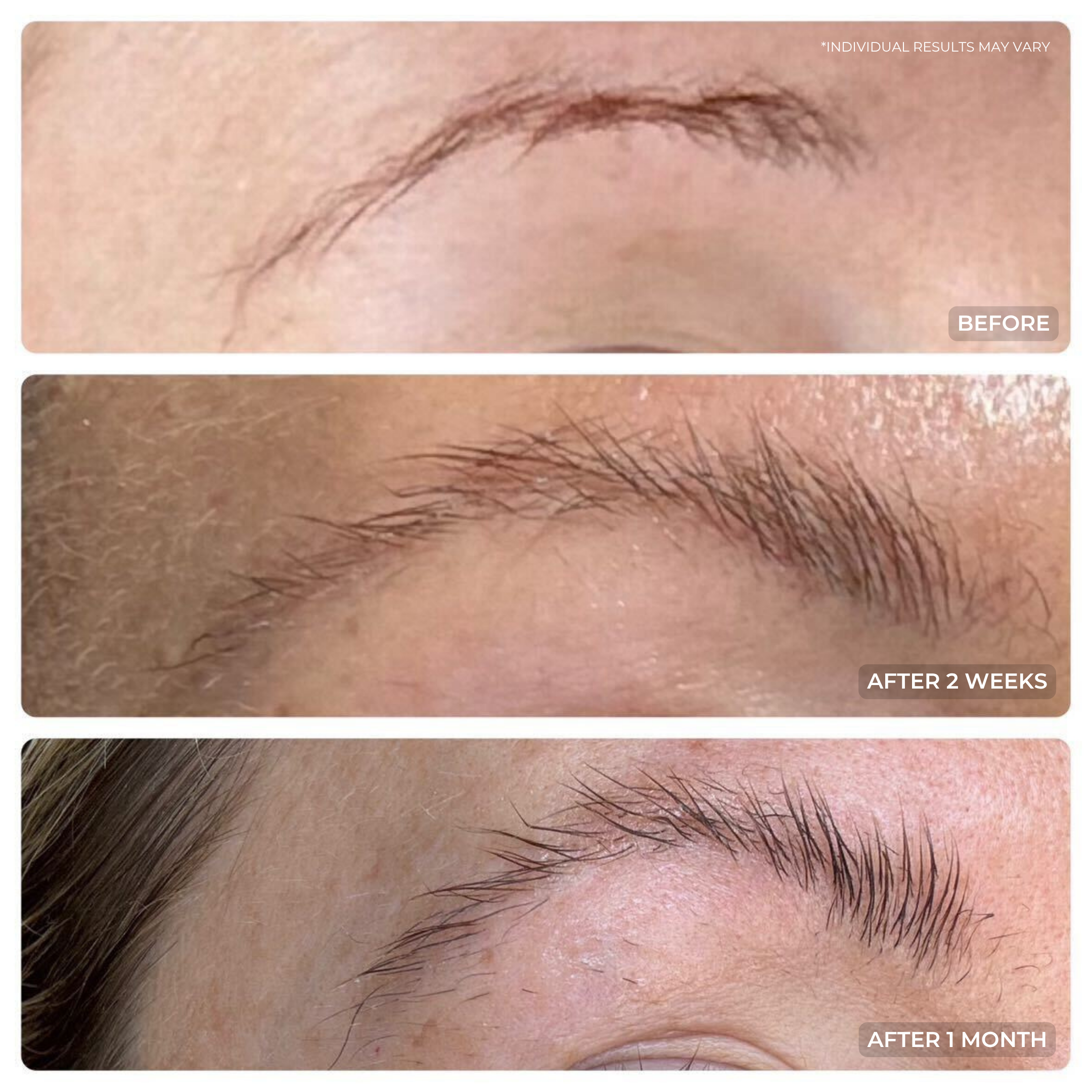 Three close-up images of a person’s eyebrow show growth progress: a thin eyebrow (before), a slightly fuller eyebrow (after 2 weeks of using THE GOLDEN SECRETS Full Brow Styling Serum), and a noticeably thicker eyebrow (after 1 month)—demonstrating how this serum helps achieve fuller, thicker brows.
