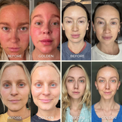 A collage of four women, each shown before and after using the Sorceress Stone Gua Sha Beauty Tool from THE GOLDEN SECRETS. The before images display redness or pale skin; the after images—enhanced by the gentle use of this facial tool—reveal smoother, more even-toned complexions, suggesting improved lymphatic circulation and subtle face sculpting effects.