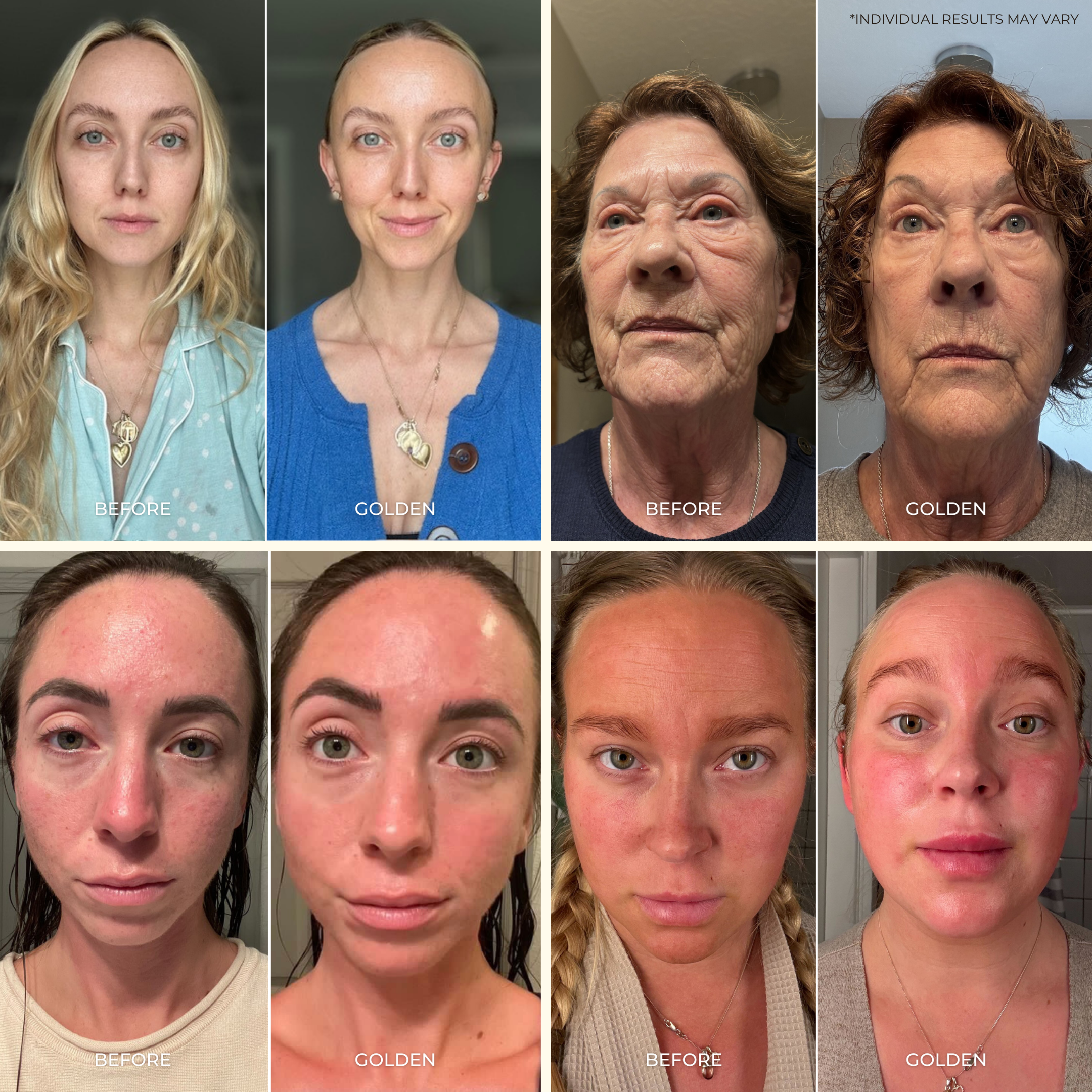 A collage of four women, each shown in a before photo and an after labeled GOLDEN, highlights visible improvements in facial skin appearance from using the Ultimate Glow Trio Kit by THE GOLDEN SECRETS for truly radiant skin.