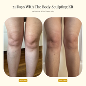 Two side-by-side photos of a person’s legs, labeled Before on the left and THE GOLDEN SECRETS Golden on the right, showing visible skin smoothness after using the Body Sculpting Kit and gua sha body tool from THE GOLDEN SECRETS for 21 days.