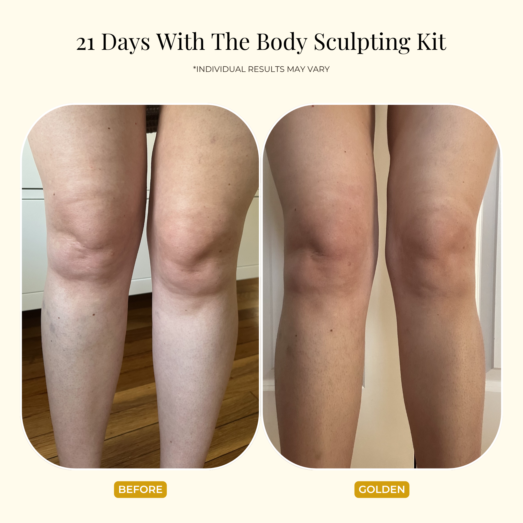 Two side-by-side photos of a person’s legs, labeled Before on the left and THE GOLDEN SECRETS Golden on the right, showing visible skin smoothness after using the Body Sculpting Kit and gua sha body tool from THE GOLDEN SECRETS for 21 days.